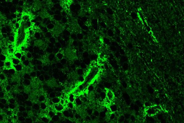 Antikörper aus dem Blut einer Patientin mit einer Entzündung im Rückenmark binden an Astrozyten-Endfüßchen um Blutgefäße im zentralen Nervensystem: Aus dem Blut einer Patientin mit einer Entzündung im Rückenmark haben die Forschenden Antikörper gereinigt und dann auf einen histologischen Schnitt des Gehirns gegeben. Die Bindung dieser Antikörper wurde sichtbar gemacht mit einem zweiten Antikörper, der an humane Antikörper bindet und mit einem grünen Farbstoff markiert war. In weiteren Untersuchungen fand das Forscherteam heraus, dass diese Antikörper der Patientin das Protein MLC1 erkennen, das an Endfüßchen von Astrozyten (Stützzellen im Gehirn) vorkommt, die Blutgefäße umgeben.