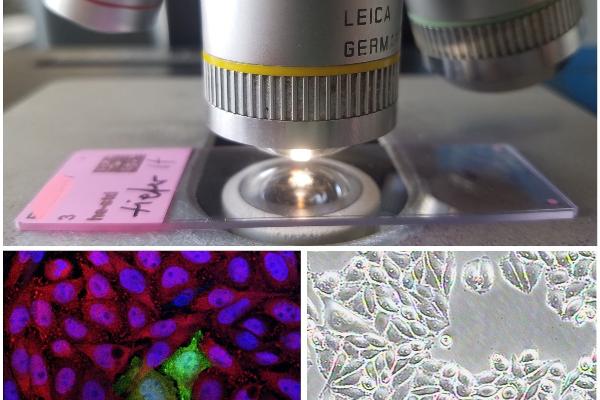 Oben: Objektträger unter Mikroskop. Unten: Bilder von etablierten Zelllinien.