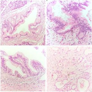 Histological growth patterns
