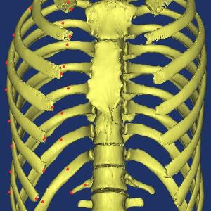 Landmarken auf Thorax