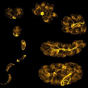 Development of Toxoplasma gondii during the lytic cycle