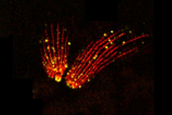 Ultraexpansion microscopy of extracellular tachyzoites of Toxoplasma gondii with labelling of microtubules and methylation