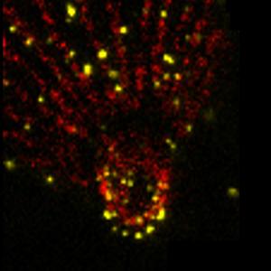 Ultra expansion microscopy of extracellular tachyzoites of Toxoplasma gondii with labelling of microtubules and methylation. Focus on a parasite conoid.