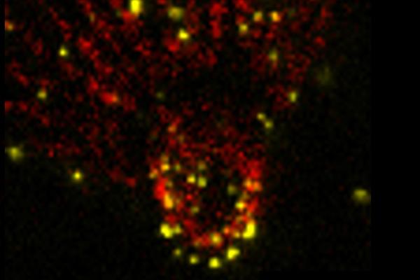 Ultra expansion microscopy of extracellular tachyzoites of Toxoplasma gondii with labelling of microtubules and methylation. Focus on a parasite conoid.