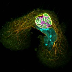 Cell infected with Toxoplasma gondii tachyzoites