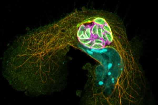 Cell infected with Toxoplasma gondii tachyzoites