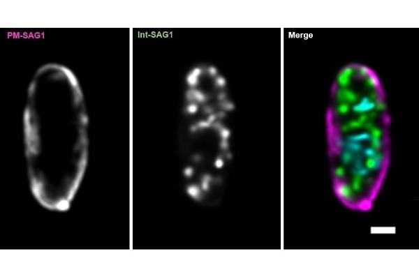 Differentiation of the different populations of the most important surface antigen SAG1 of Toxoplasma gondii in extracellular tachyzoites