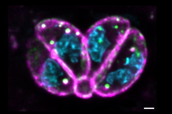 Plasma membrane labelling of Toxoplasma gondii tachyzoites