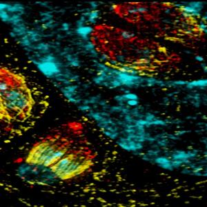 Intracellular tachyzoites of Toxoplasma gondii