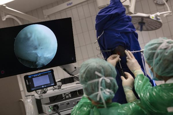 arthroscopy