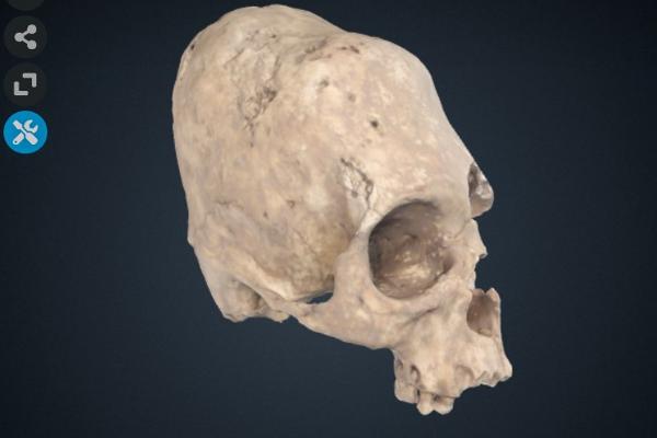Cranium of individual