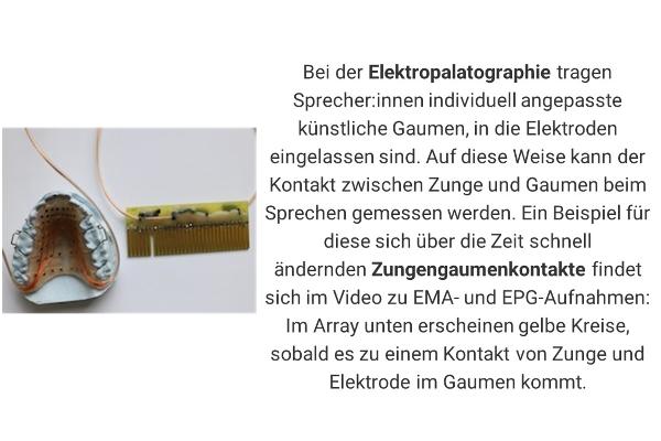 Bei der Elektropalatographie tragen Sprecher:innen individuell angepasste künstliche Gaumen, in die Elektroden eingelassen sind. Auf diese Weise kann der Kontakt zwischen Zunge und Gaumen beim Sprechen gemessen werden. Ein Bsp. für diese sich über die Zeit schnell ändernden Zungengaumenkontakte findet sich im Video zu EMA- und EPG-Aufnahmen: Im Array unten erscheinen gelbe Kreise, sobald es zu einem Kontakt von Zunge und Elektrode im Gaumen kommt.