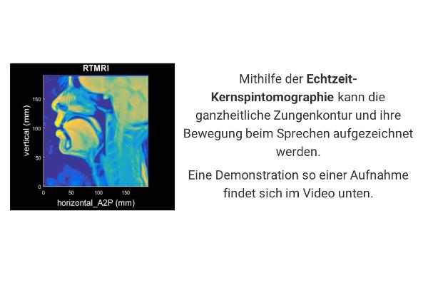 Mithilfe der Echtzeit-Kernspintomographie kann die ganzheitliche Zungenkontur und ihre Bewegung beim Sprechen aufgezeichnet werden. Eine Demonstration so einer Aufnahme findet sich im Video unten.