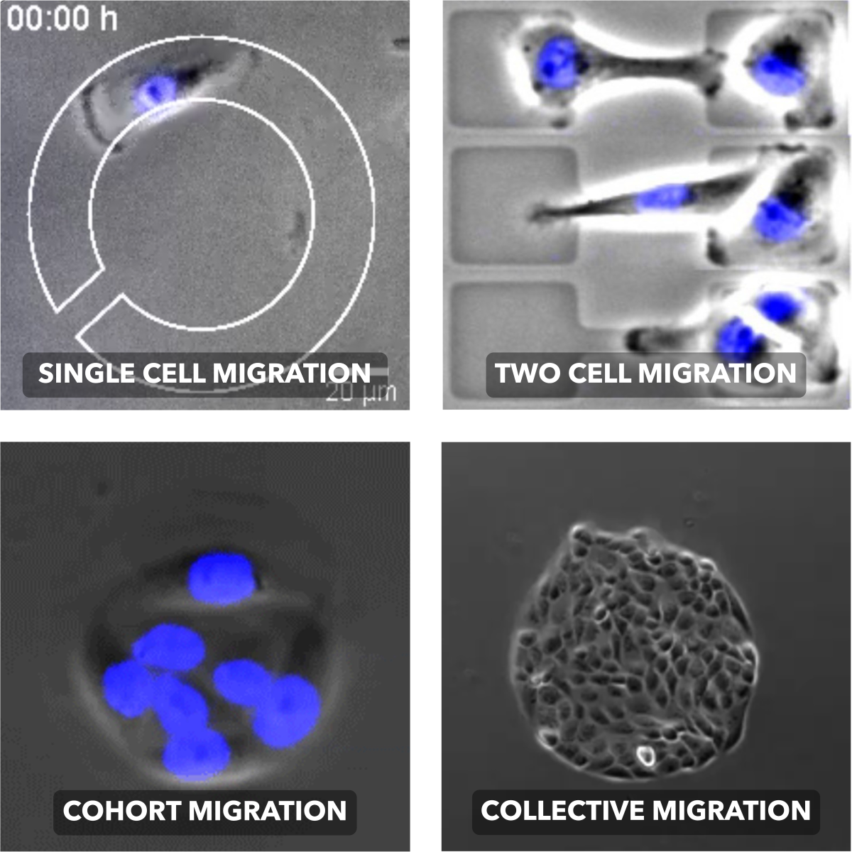 Cell migration - Soft Matter Physics - Fakulty of Physics - LMU Munich