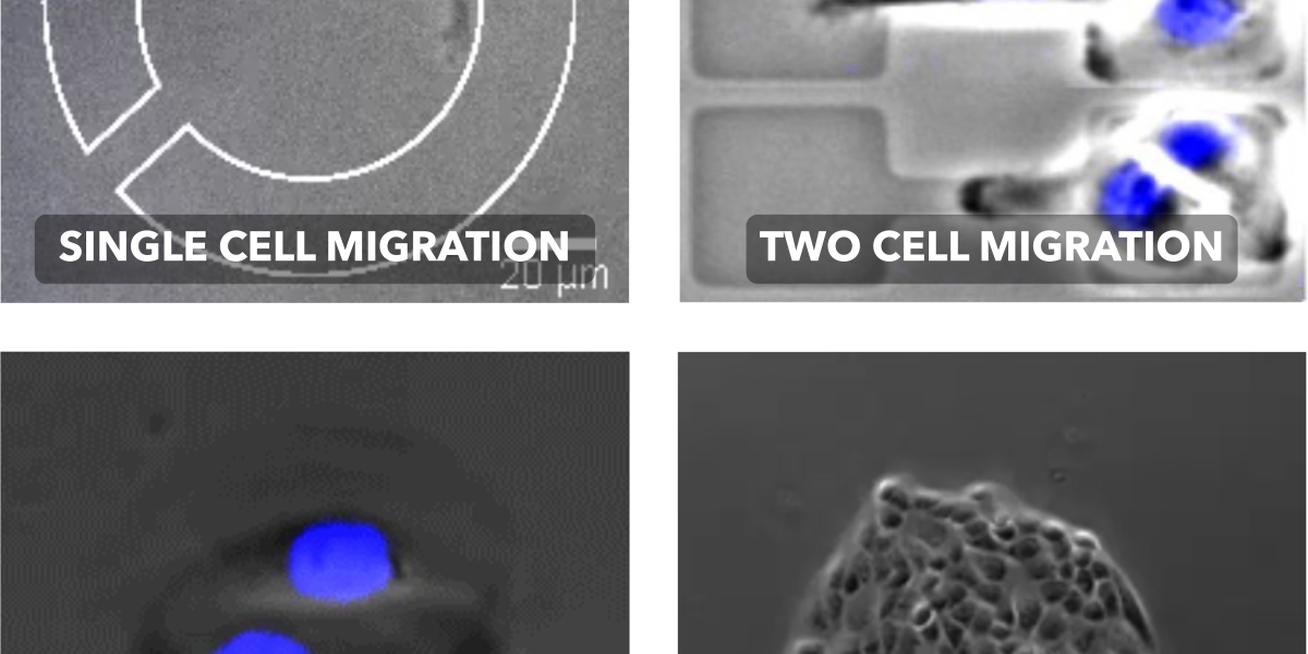Cell migration - Soft Matter Physics - Fakulty of Physics - LMU Munich