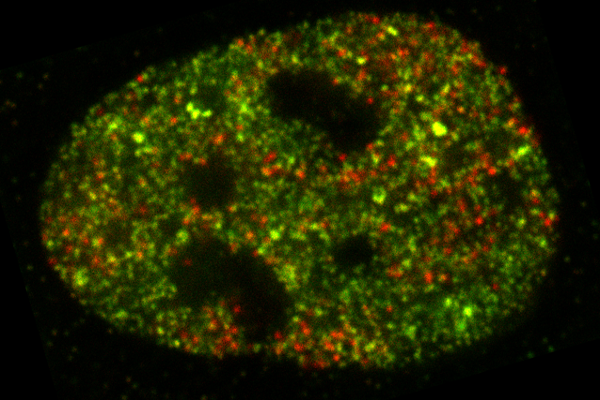 Fluorescence microscopy image of a cell nucleus with red and green molecular signals.