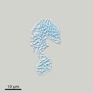 isolated nucleus with its individual