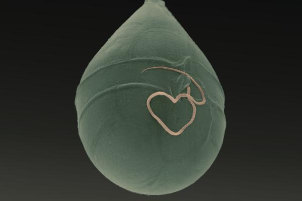 Scrippsiella acuminata