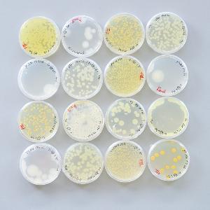 Petrischalen mit verschiedenen Kolonien