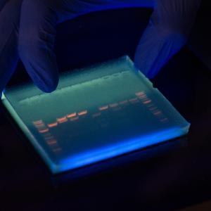 Gel with illuminated bands