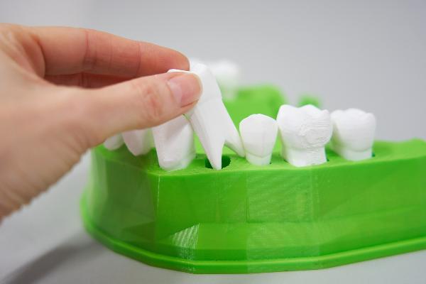 3D Druck von vergrößertem Unterkiefer mit herausnehmbaren Zähnen