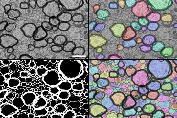 Segmentierte Elektronenmikroskopaufnahme von Gehirnzellen