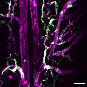 Axolotl Blut-Gehirn Schranke
