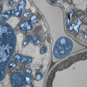 Insight into the mycorrhizal symbiosis