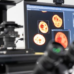 Microscoped cells on the computer