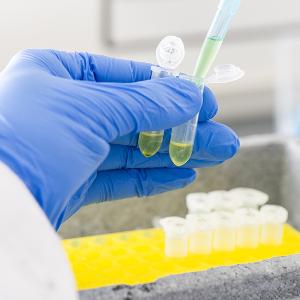 Pipettieren von Proben