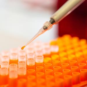 Pipettieren von Lösungen | © Carolin Bleese Pipettieren von Lösungen