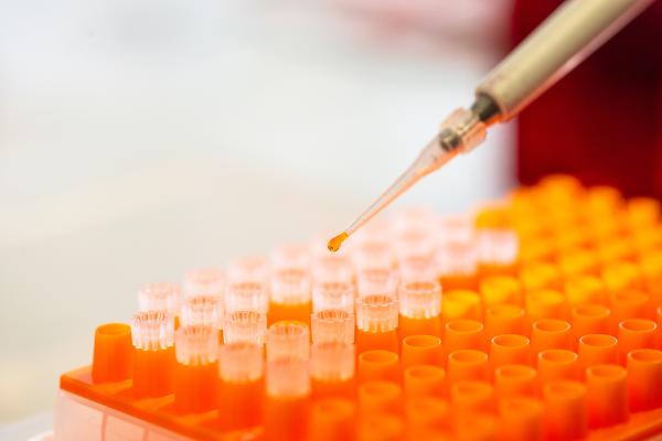 Pipettieren von Lösungen