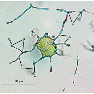 An algal cell (D) being decomposed by a parasitic aquatic fungus (H, S) (photo: W. Orsi). We are interested in these types of microbial interactions because they help determine fluxes of carbon to the seafloor and ultimately how much fixed organic carbon is returned to the atmosphere as CO2.
