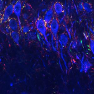 Fluorescence microscopy
