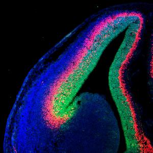 Fluorescence microscopy image
