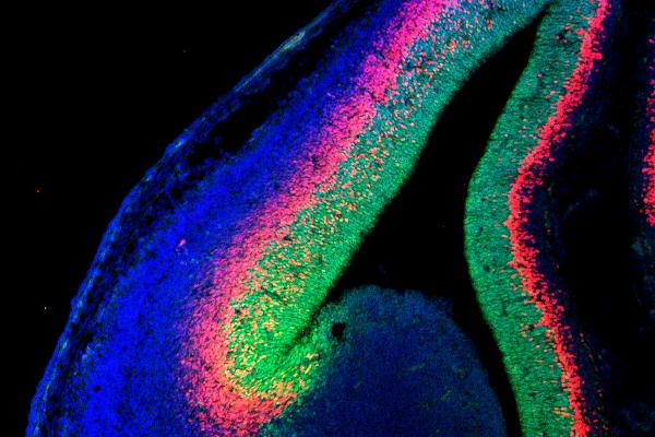 Fluorescence microscopy image