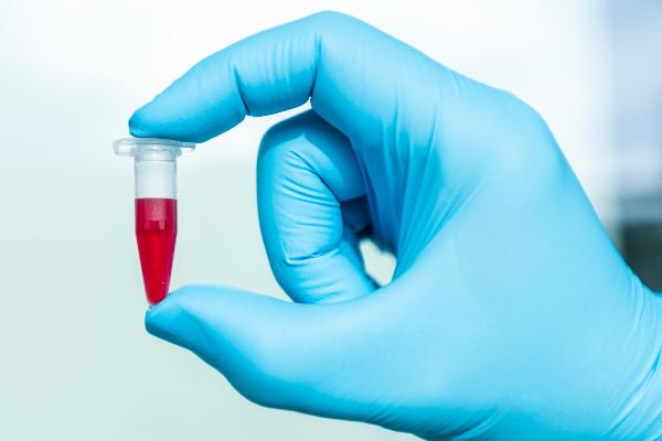 A hand holding a sample filled with liquid