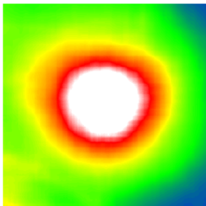 Vorhergesagte Netzhautdicke auf Basis von Fundus-Bildern.