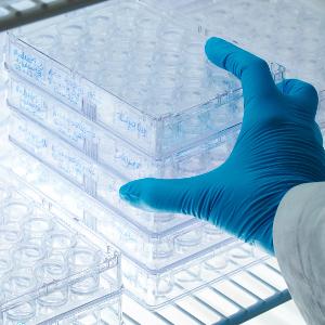 Eine Person mit blauen Schutzhandschuhen ordnet Plastikträger ein