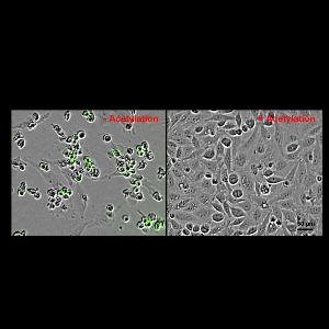 Krebszellen ohne Acetylierung (links) und Kontrollzellen (rechts). Zellen, bei denen Zelltod eingetreten ist, erscheinen in grün