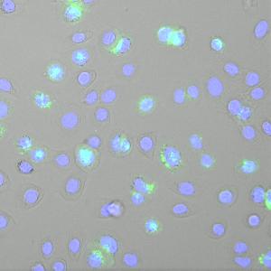 Aufnahme von Keratinozyten-Zelllinie, die mit Semliki Forest Virus infiziert wurde (blau: Zellkerne; grün: doppelsträngige RNA).