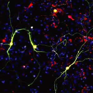 Darstellung von reprogrammierten Neuronen bei Expression des proneuralen Faktors Ascl1 und neuronale mitochondriale Proteine