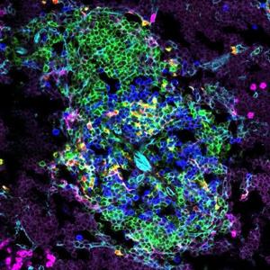 Mikroskopische Analyse von dendritischen Zellen (rot/gelb) und T-Zellen (blau) in der Milz von neugeborenen, 8 Tage alten Mäusen