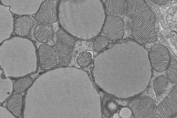 Images of mitochondria in brown fat cells using electron microscopy