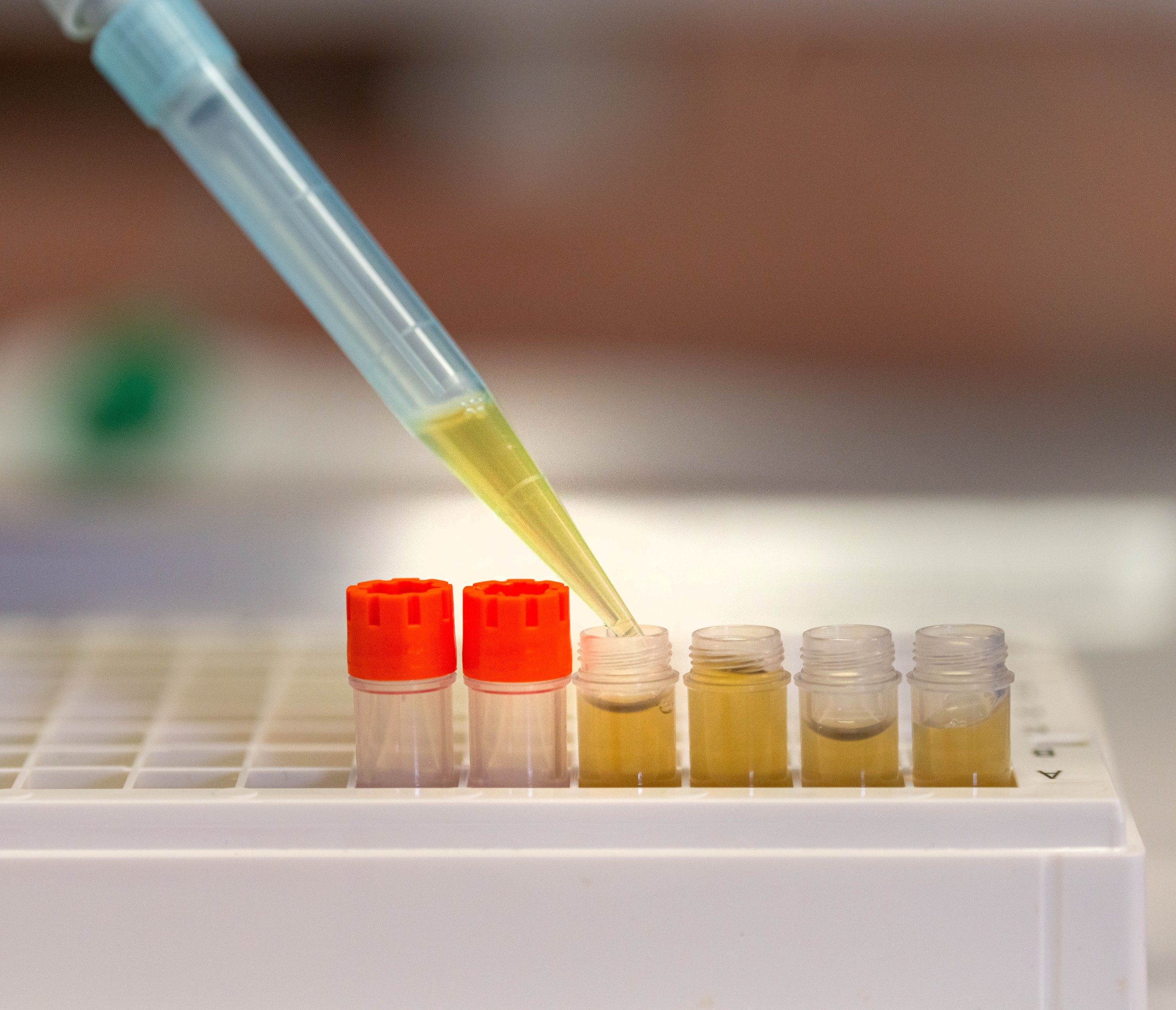 Aufbereitung von Blutproben