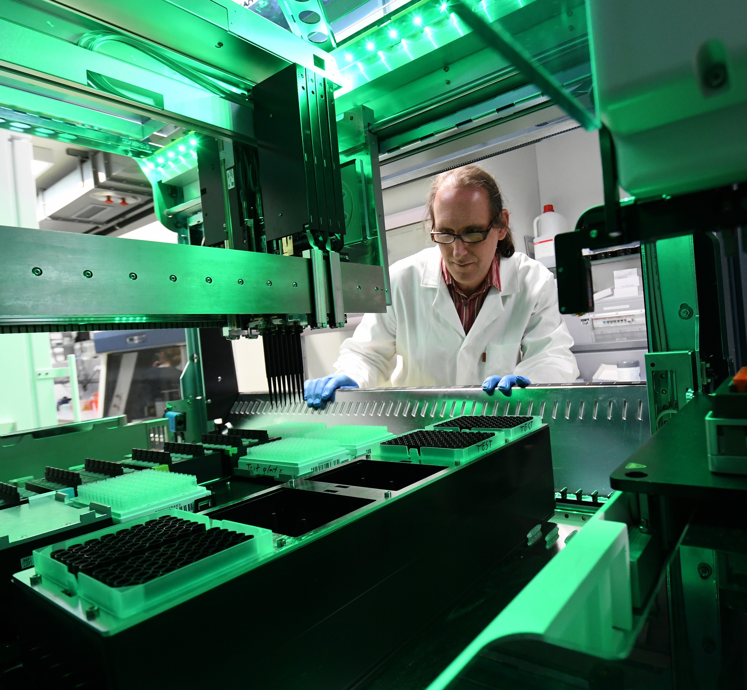 The BIRD-team analyses thousands of human blood plasma samples using infrared molecular fingerprinting.