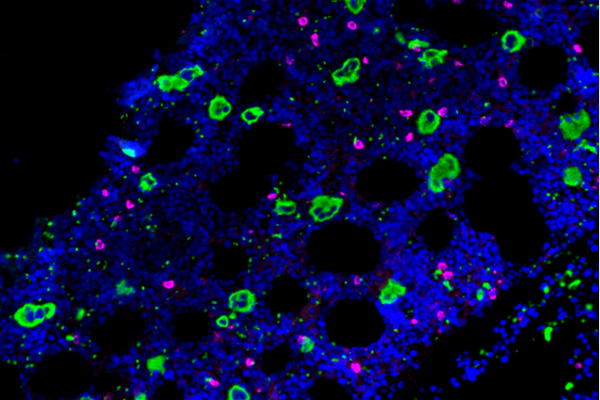 Megakaryozyten (grün), die von plasmazytoiden dendritischen Zellen (magenta) in einem menschlichen Knochenmarkschnitt kontrolliert werden