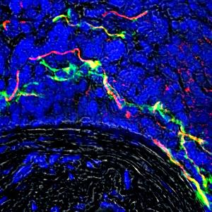 Nervennetzwerk in erkrankter Arterie