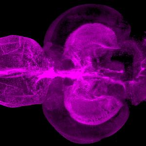 Zebrafischgehirn mit magentafarben markierten Stammzellen