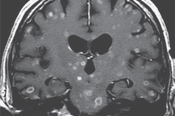 AIによる説明機能が放射線診断精度を向上 （Medical diagnoses: how AI explanations help doctors）
